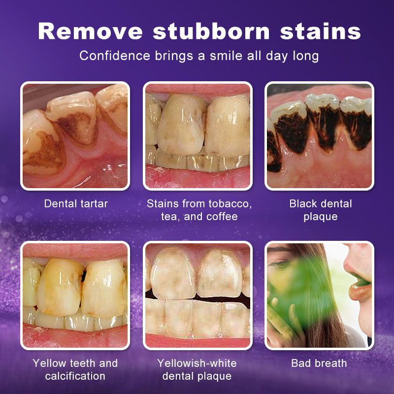 Leafora Purple Teeth Whitening Strips - 7/21 Whitening Sessions - Safe for Enamel - Non Sensitive Teeth Whitening - Peroxide-Free