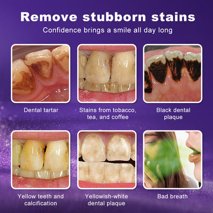 Leafora Purple Teeth Whitening Strips - 7/21 Whitening Sessions - Safe for Enamel - Non Sensitive Teeth Whitening - Peroxide-Free